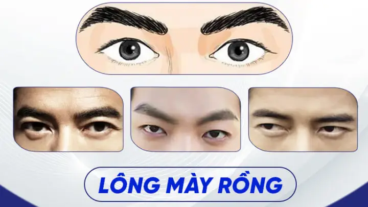 Tướng Lông Mày Ngang Nam