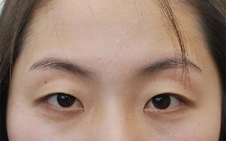 Tướng Mắt Hạc Tướng Mắt Hạc