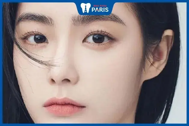 Tướng Mắt Lệch Tướng Mắt Lệch