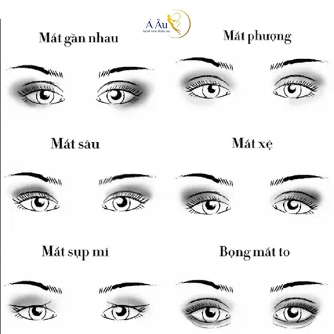 Tướng Mắt Lệch Tướng Mắt Lệch