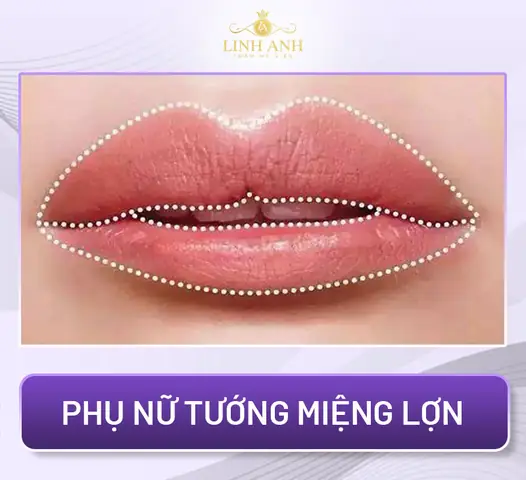 Tướng Môi Trên Cong Lên Tướng Môi Trên Cong Lên