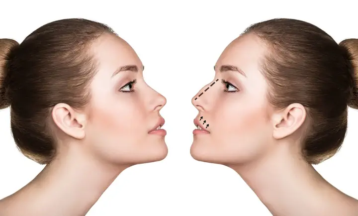 Tướng Mũi Diều Hâu Nữ Tướng Mũi Diều Hâu Nữ