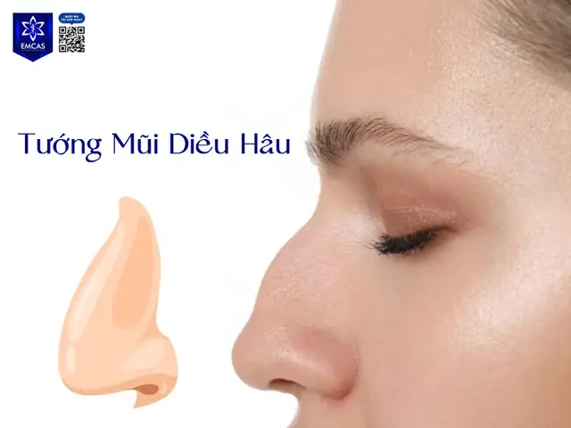Tướng Mũi Diều Hâu Nữ Tướng Mũi Diều Hâu Nữ