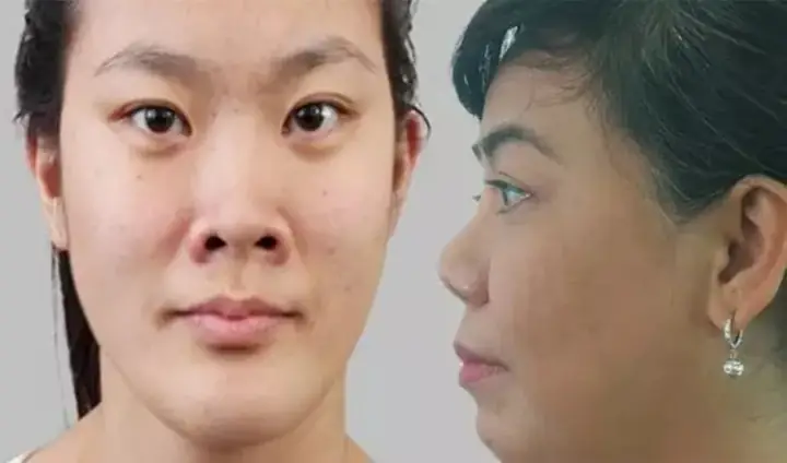 Tướng Mũi Hếch Phụ Nữ Tướng Mũi Hếch Phụ Nữ