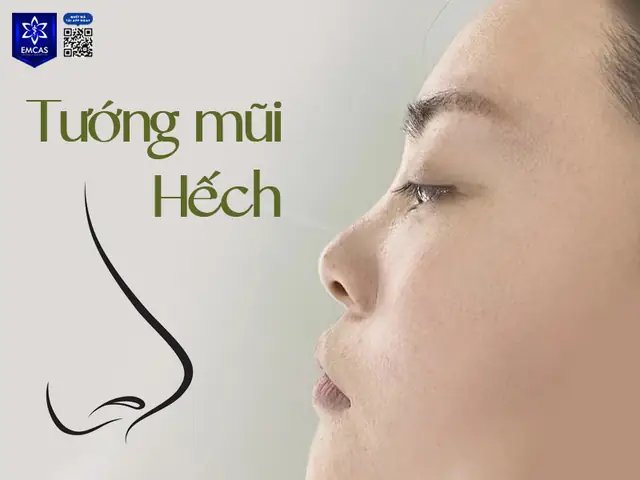 Tướng Mũi Hếch Phụ Nữ Tướng Mũi Hếch Phụ Nữ