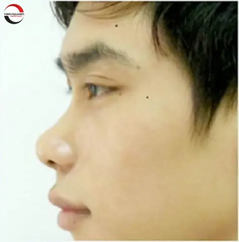 Tướng Mũi Tẹt Tướng Mũi Tẹt
