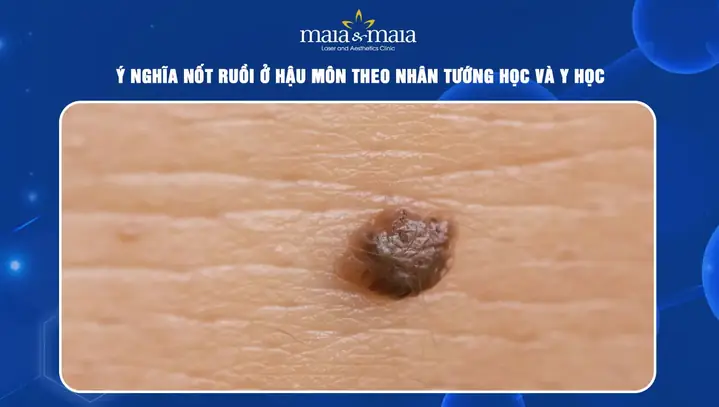 Tướng Người Có Lông Ở Hậu Môn Tướng Người Có Lông Ở Hậu Môn