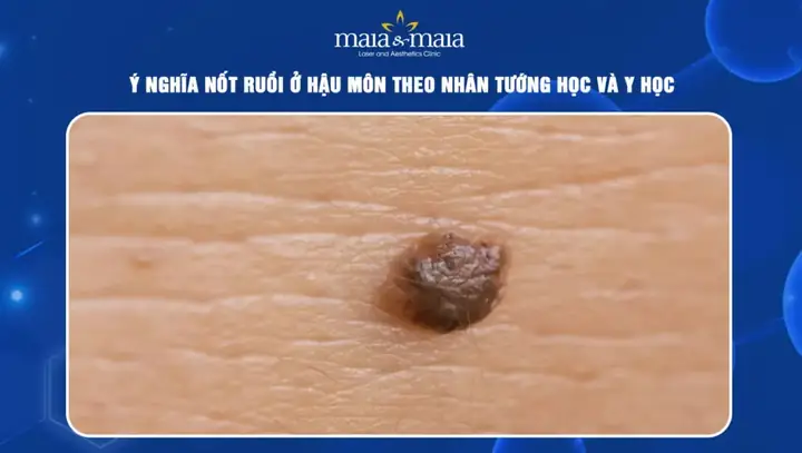 Tướng Người Có Lông Ở Hậu Môn Tướng Người Có Lông Ở Hậu Môn