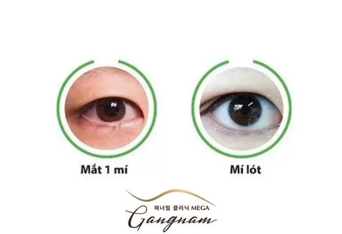 Tướng Người Mắt Mí Lót