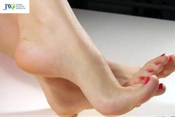 Tướng Phụ Nữ Có Bàn Chân Nhỏ Tướng Phụ Nữ Có Bàn Chân Nhỏ
