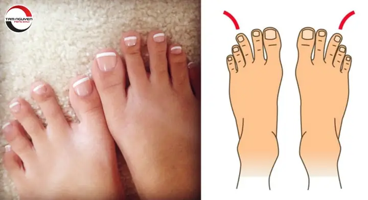 Tướng Phụ Nữ Có Bàn Chân Nhỏ Tướng Phụ Nữ Có Bàn Chân Nhỏ