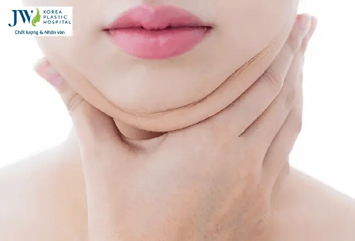 Tướng Phụ Nữ Có Nọng Cằm