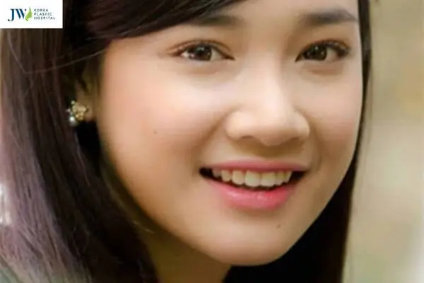 Tướng Phụ Nữ Đầu Mũi To Tướng Phụ Nữ Đầu Mũi To