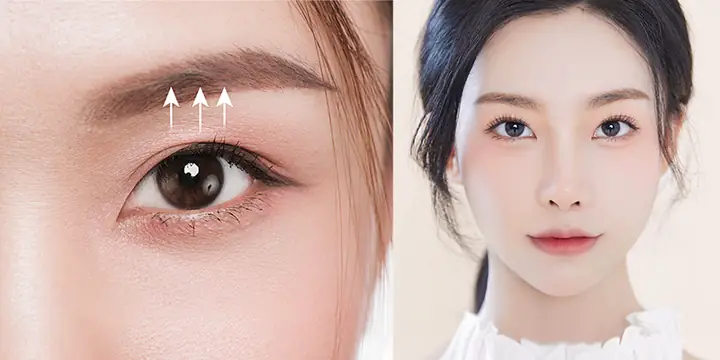 Tướng Phụ Nữ Mắt Sụp Mí Tướng Phụ Nữ Mắt Sụp Mí