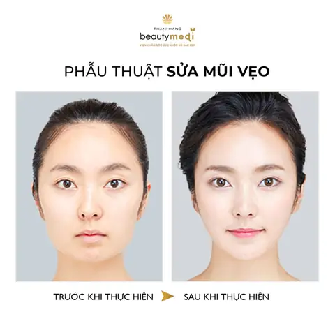 Tướng Phụ Nữ Mũi Cao Thẳng Tướng Phụ Nữ Mũi Cao Thẳng