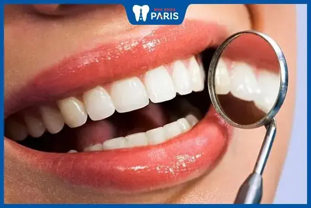 Tướng Phụ Nữ Răng Không Đều Tướng Phụ Nữ Răng Không Đều
