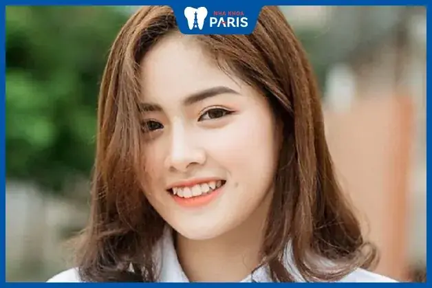 Tướng Phụ Nữ Răng Không Đều Tướng Phụ Nữ Răng Không Đều