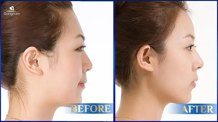 Tướng Phụ Nữ Trán Ngắn Tướng Phụ Nữ Trán Ngắn