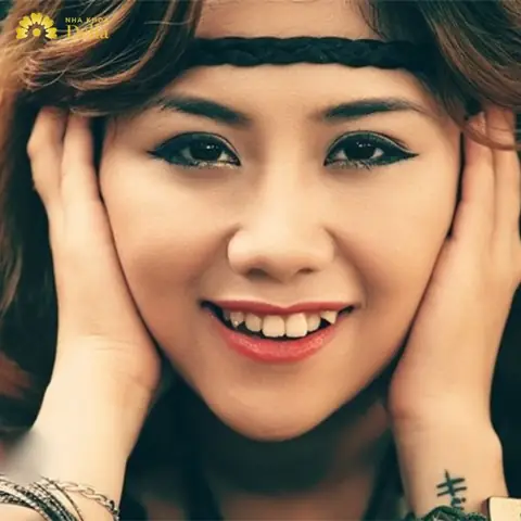 Tướng Răng Hổ