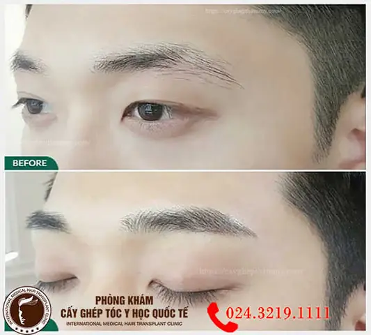 Tướng Số Đàn Ông Lông Mày Nhạt Tướng Số Đàn Ông Lông Mày Nhạt