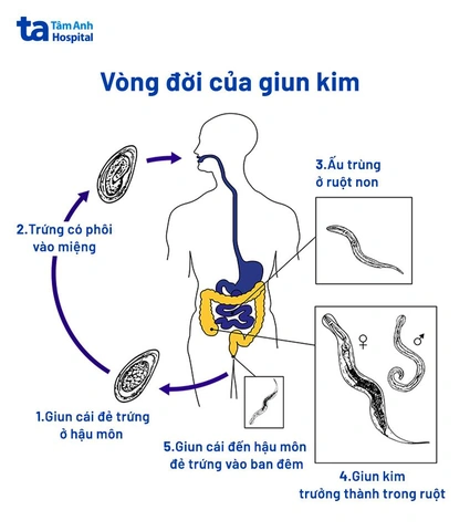 100+ Hình Ảnh Giun Kim Hd Đẹp Nhất 2026 – Bộ Sưu Tập Đầy Đủ, Tải Nhanh, Sử Dụng Đa Năng