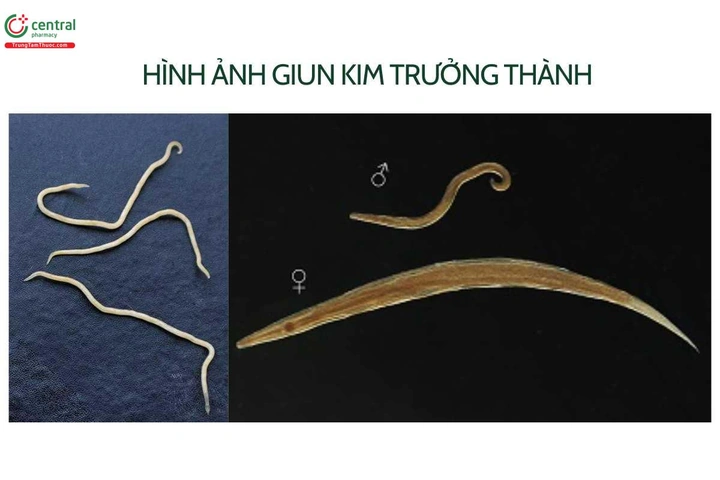 100+ Hình Ảnh Giun Kim Hd Đẹp Nhất 2026 – Bộ Sưu Tập Đầy Đủ, Tải Nhanh, Sử Dụng Đa Năng