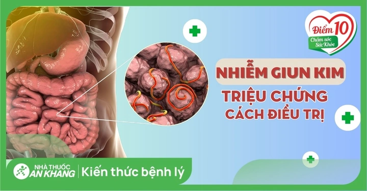 100+ Hình Ảnh Giun Kim Hd Đẹp Nhất 2026 – Bộ Sưu Tập Đầy Đủ, Tải Nhanh, Sử Dụng Đa Năng