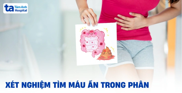 100+ Hình Ảnh Giun Kim Hd Đẹp Nhất 2026 – Bộ Sưu Tập Đầy Đủ, Tải Nhanh, Sử Dụng Đa Năng