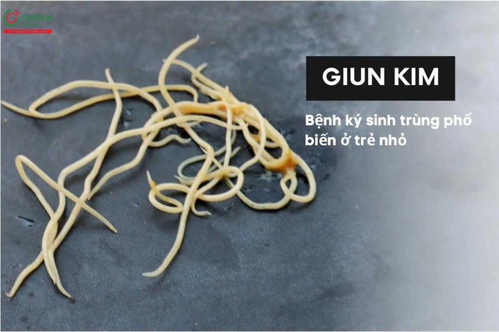 100+ Hình Ảnh Giun Kim Hd Đẹp Nhất 2026 – Bộ Sưu Tập Đầy Đủ, Tải Nhanh, Sử Dụng Đa Năng