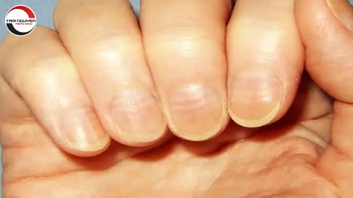 Xem Tướng Móng Tay Đàn Ông Xem Tướng Móng Tay Đàn Ông