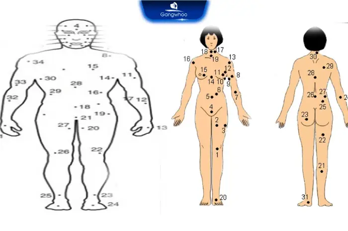 Vị Trí Nốt Ruồi Giàu Sang Phú Quý Trên Cơ Thể Nam Và Nữ Theo Nhận Định Phong Thủy