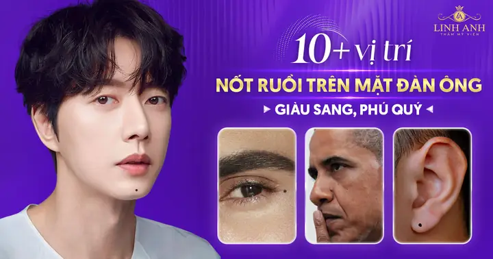 Vị Trí Nốt Ruồi Giàu Sang Phú Quý Trên Cơ Thể Nam Và Nữ Theo Nhận Định Phong Thủy