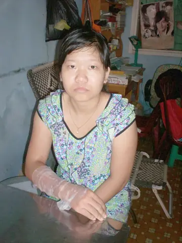 Giải Mã Điềm Báo Bị Bỏng Trước Khi Thi Và Những Kiêng Kỵ Sĩ Tử Cần Biết Giải Mã Điềm Báo Bị Bỏng Trước Khi Thi Và Những Kiêng Kỵ Sĩ Tử Cần Biết