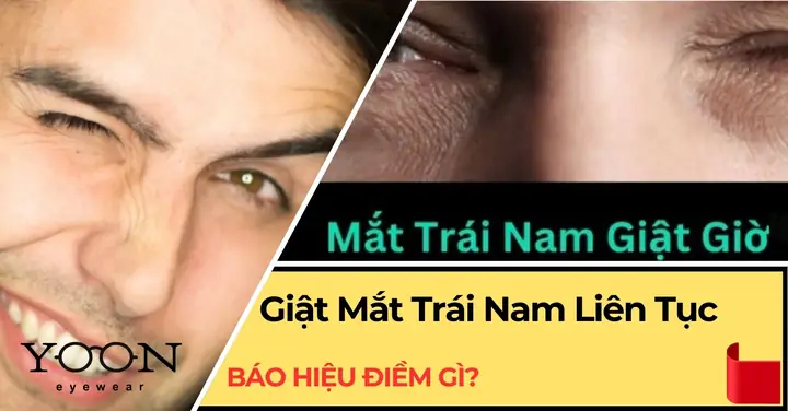 Giải Mã Giật Mắt Trái Ở Nam Là Điềm Gì: Ý Nghĩa Theo Giờ Và Nguyên Nhân Y Khoa Giải Mã Giật Mắt Trái Ở Nam Là Điềm Gì: Ý Nghĩa Theo Giờ Và Nguyên Nhân Y Khoa