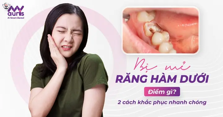 Giải Đáp Bị Mẻ Răng Hàm Dưới Điềm Gì Theo Nhân Tướng Học Và Góc Nhìn Nha Khoa Giải Đáp Bị Mẻ Răng Hàm Dưới Điềm Gì Theo Nhân Tướng Học Và Góc Nhìn Nha Khoa