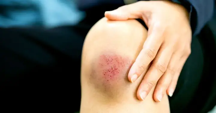 Giải Mã Điềm Báo Bị Té Xe Có Ý Nghĩa Gì Trong Đời Thực Và Giấc Mơ Giải Mã Điềm Báo Bị Té Xe Có Ý Nghĩa Gì Trong Đời Thực Và Giấc Mơ