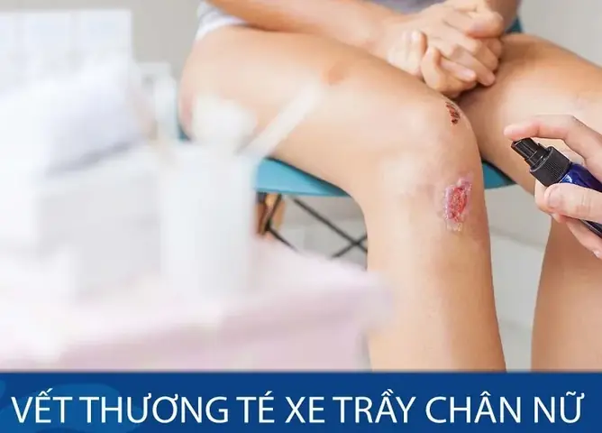 Giải Mã Điềm Báo Bị Té Xe Có Ý Nghĩa Gì Trong Đời Thực Và Giấc Mơ Giải Mã Điềm Báo Bị Té Xe Có Ý Nghĩa Gì Trong Đời Thực Và Giấc Mơ