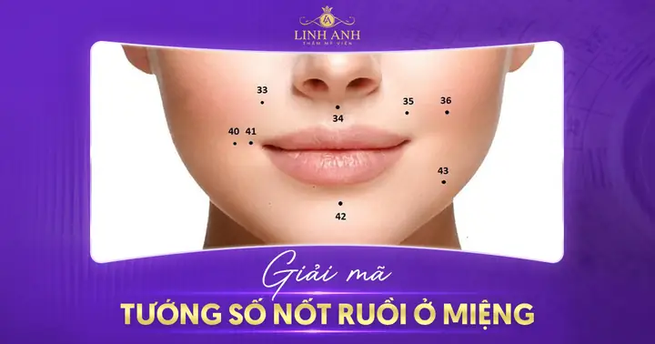 Giải Mã Ý Nghĩa Nốt Ruồi Quanh Miệng Theo Nhân Tướng Học: Tài Lộc, Tình Duyên Và Điềm Lành Xui
