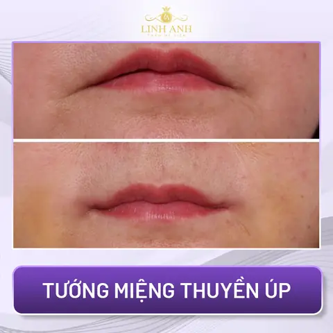 Tổng Hợp Các Tướng Miệng Phổ Biến Và Ý Nghĩa Trong Nhân Tướng Học: Nhận Diện Tính Cách, Vận Mệnh Tổng Hợp Các Tướng Miệng Phổ Biến Và Ý Nghĩa Trong Nhân Tướng Học: Nhận Diện Tính Cách, Vận Mệnh