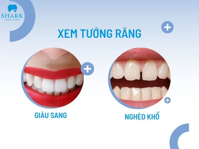 Giải Mã Các Tướng Răng Trong Nhân Tướng Học: Danh Sách Phổ Biến, Ý Nghĩa Vận Mệnh Và Tính Cách