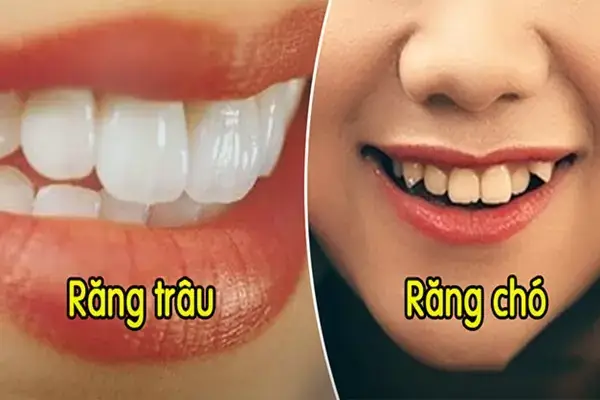 Giải Mã Các Tướng Răng Trong Nhân Tướng Học: Danh Sách Phổ Biến, Ý Nghĩa Vận Mệnh Và Tính Cách