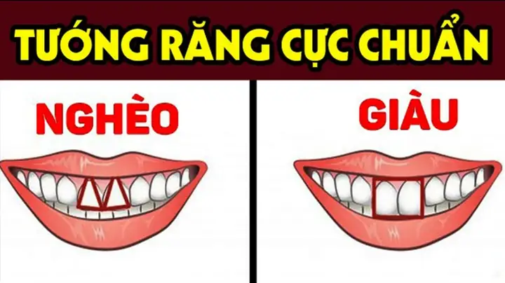 Giải Mã Các Tướng Răng Trong Nhân Tướng Học: Danh Sách Phổ Biến, Ý Nghĩa Vận Mệnh Và Tính Cách