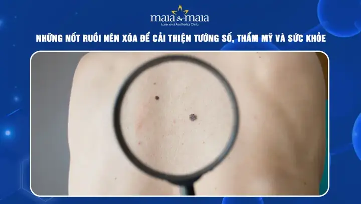 Cách Cải Thiện Tướng Số Đổi Vận Mệnh: 10+ Bí Quyết Từ Nhân Tướng Học Và Tu Tâm Dưỡng Tính