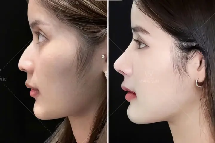 Cách Cải Thiện Tướng Số Đổi Vận Mệnh: 10+ Bí Quyết Từ Nhân Tướng Học Và Tu Tâm Dưỡng Tính