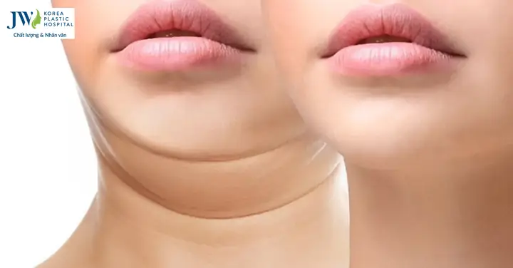 Giải Mã Ý Nghĩa Nọng Cằm Trong Tướng Số: Tính Cách, Sự Nghiệp & Tình Duyên Của Nam - Nữ Giải Mã Ý Nghĩa Nọng Cằm Trong Tướng Số: Tính Cách, Sự Nghiệp & Tình Duyên Của Nam - Nữ