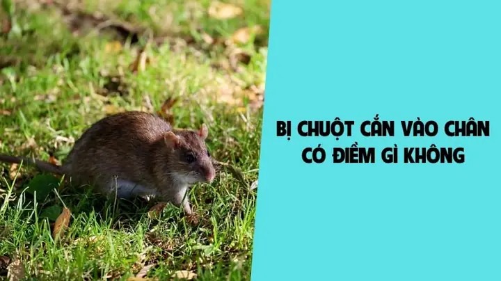 Giải Mã Hiện Tượng Chân Hay Bị Va Vào Cửa Bầm Tím: Điềm Báo Gì Và Nguyên Nhân Sức Khỏe Cần Biết Giải Mã Hiện Tượng Chân Hay Bị Va Vào Cửa Bầm Tím: Điềm Báo Gì Và Nguyên Nhân Sức Khỏe Cần Biết