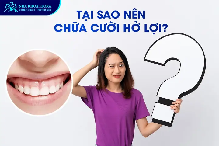 Giải Mã Tướng Số Con Gái Cười Hở Lợi: Tốt Hay Xấu Theo Nhân Tướng Học? Giải Mã Tướng Số Con Gái Cười Hở Lợi: Tốt Hay Xấu Theo Nhân Tướng Học?