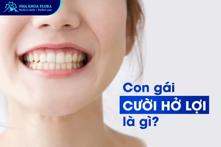 Giải Mã Tướng Số Con Gái Cười Hở Lợi: Tốt Hay Xấu Theo Nhân Tướng Học? Giải Mã Tướng Số Con Gái Cười Hở Lợi: Tốt Hay Xấu Theo Nhân Tướng Học?