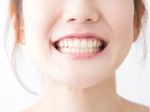Giải Mã Tướng Số Con Gái Cười Hở Lợi: Tốt Hay Xấu Theo Nhân Tướng Học? Giải Mã Tướng Số Con Gái Cười Hở Lợi: Tốt Hay Xấu Theo Nhân Tướng Học?