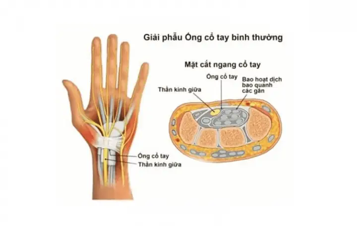Tìm Hiểu Đau Cổ Tay Phải: Nguyên Nhân, Triệu Chứng Và Cách Chữa Trị Tìm Hiểu Đau Cổ Tay Phải: Nguyên Nhân, Triệu Chứng Và Cách Chữa Trị
